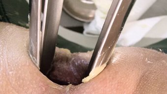 医生用巨大的马窥器和...